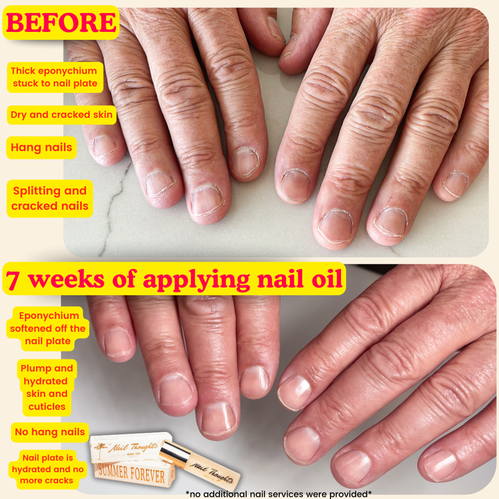 Nail Thoughts Summer Forever Nail Oil 10ml